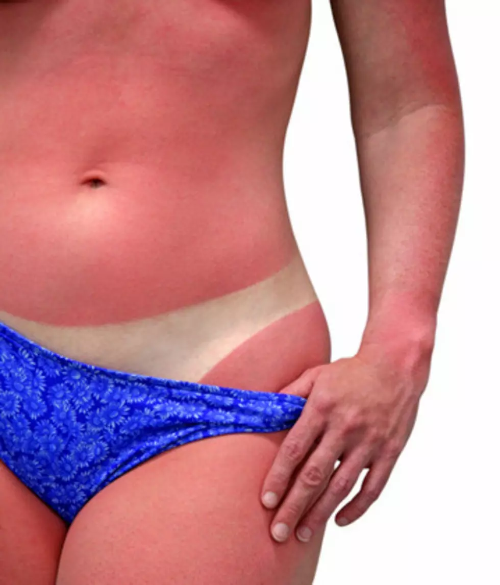 People Claim Honest Brand Sunscreen is Causing Horrible Sunburns